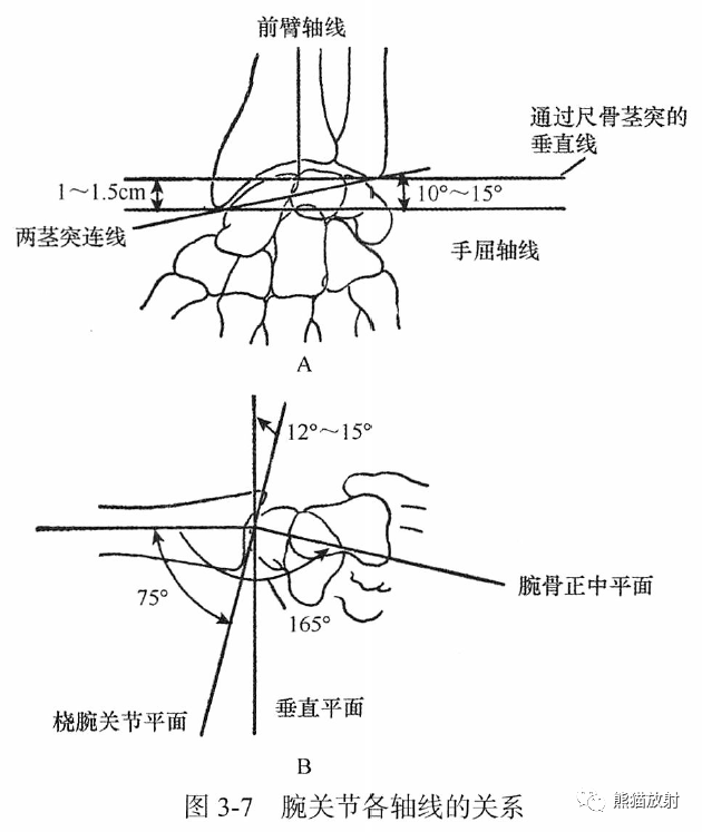 對於骨病及關節疾患所引起的骨骼和關節關係失常能做到較正確的估計