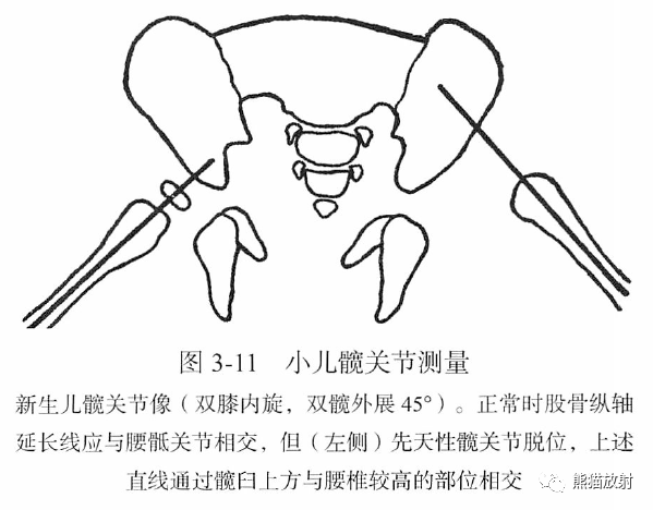 骨关节丨画线及测量