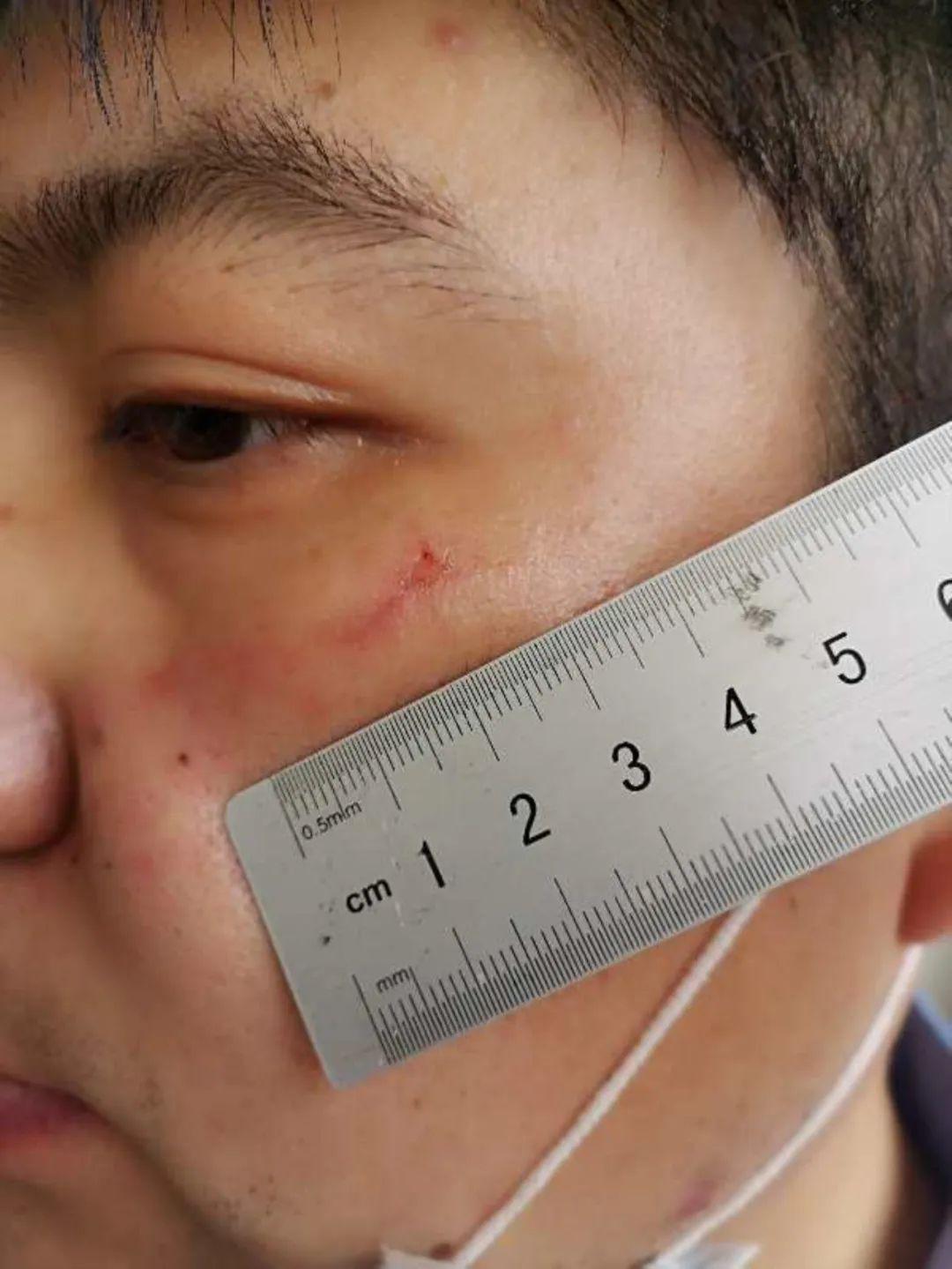 暴力抗法!鹰潭贵溪一女子抓伤交警,结果