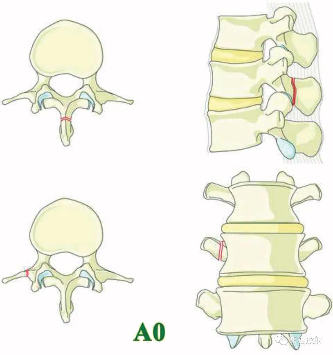 第二腰椎横突图片
