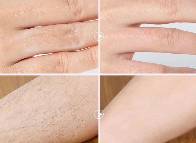 论春天的正确打开方式…我彻底酸了_脱毛