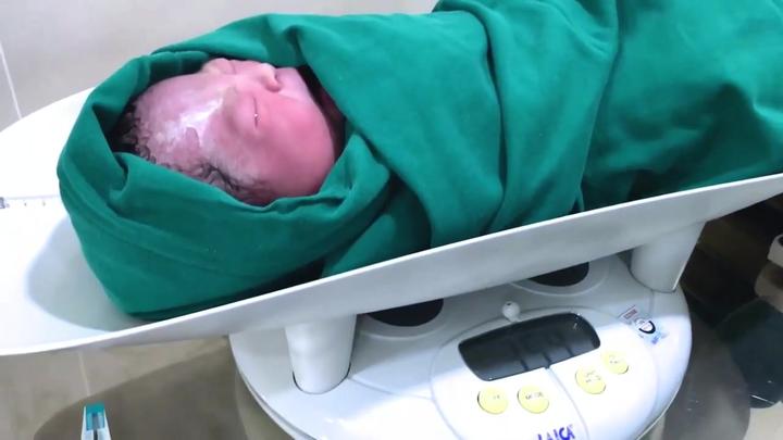 刚出生的小婴儿全身好红头上却有一块白好特别的宝宝