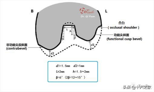 齿美备牙指南一步一步做好嵌体高嵌体牙体预备