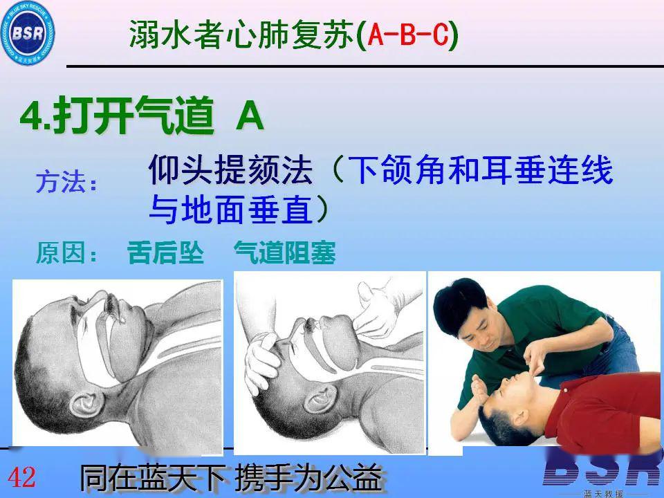  舌后墜能自然恢復(fù)么_舌后墜有什么癥狀