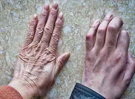 痿症老专家刘泉鹏讲解什么是肌萎缩侧索硬化症会危及生命吗