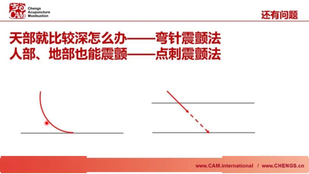 震颤手法的真意你懂吗弯针震颤点刺震颤何时用