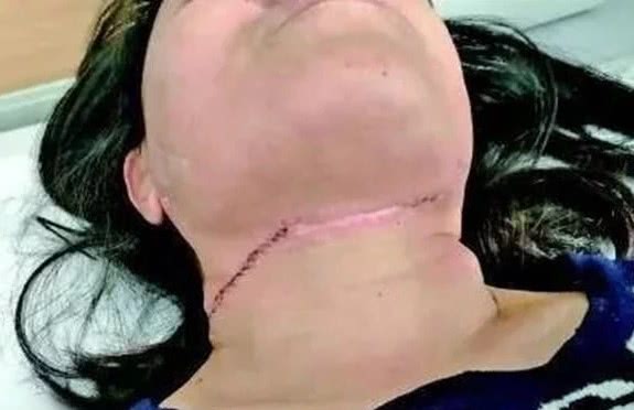 风筝伤人割喉图片图片