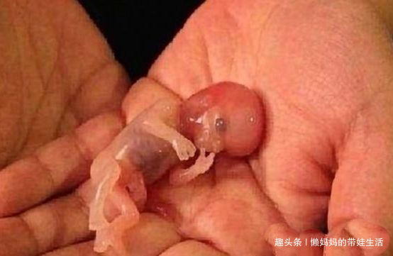 怀孕11周流产胎儿图片图片