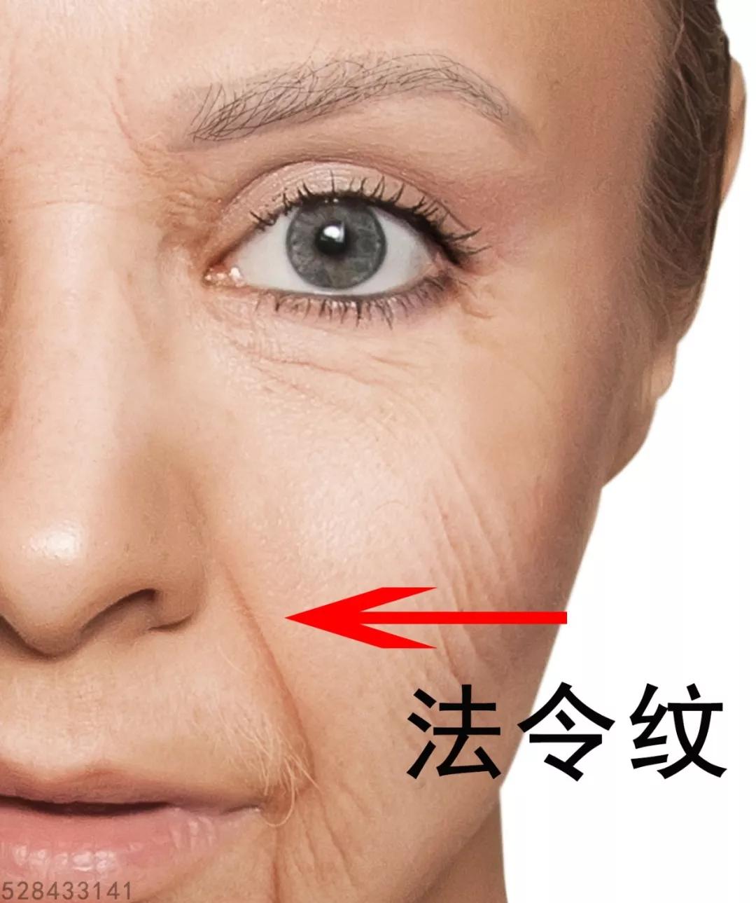 魏红军:脸又大又平怎么办?可能是这个地方造成的!_鼻子