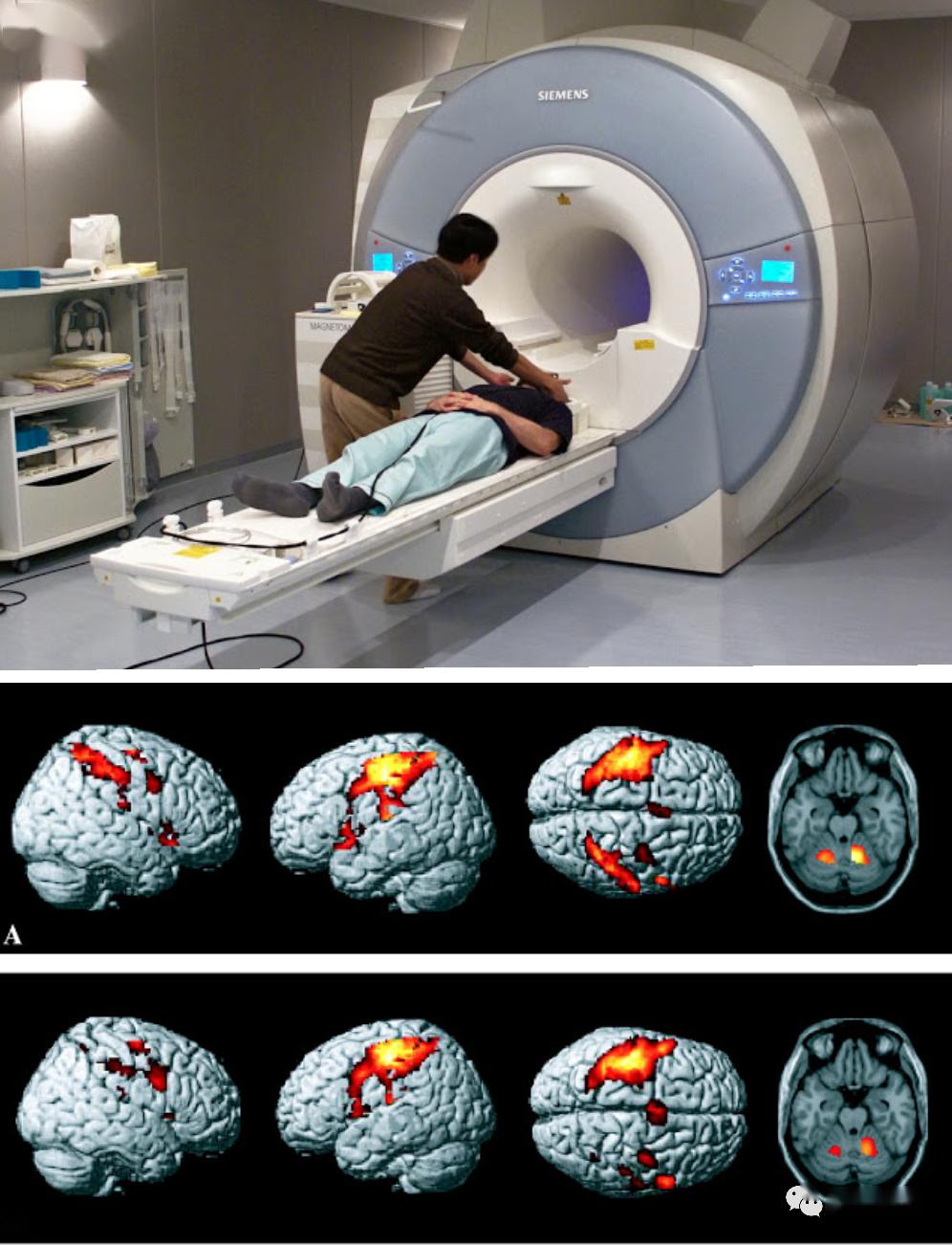 利用功能性磁力共振做的实验神经营销的理念之所以备受青睐,是因为