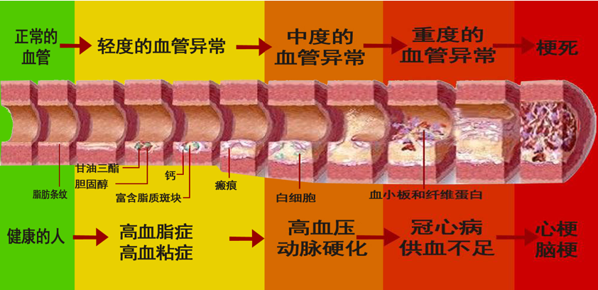 是什麼把血管堵住了?