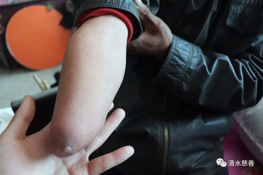 苦难总有尽头贫苦也要坚持清水慈善为庄河市荷花山镇