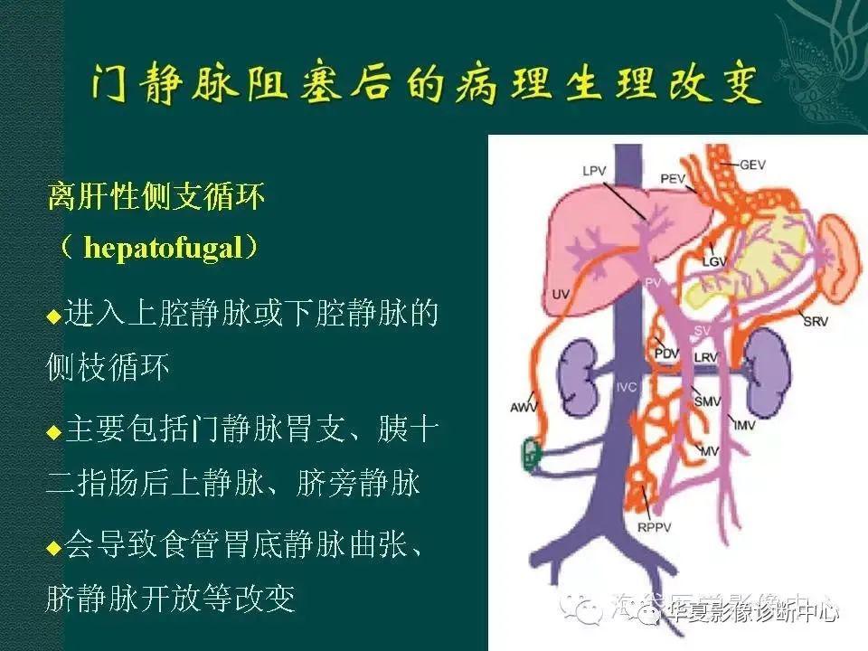 临床提示:消化道出血,你会想到ctpv吗?_门静脉