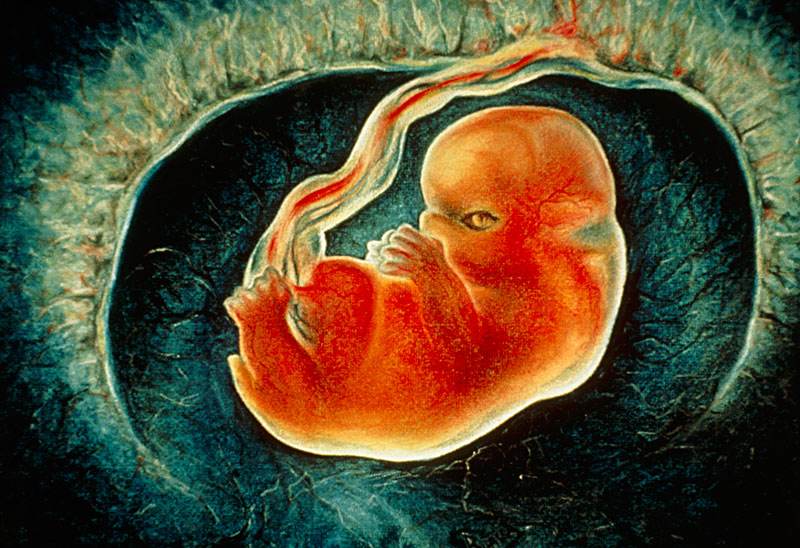 脐带绕颈危害有多大,应该如何避免,孕妈要早知道_胎儿