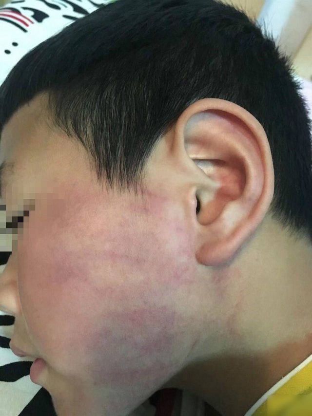 原创儿子成绩不好父亲当着师生的面打他父子总是吵架如何化解