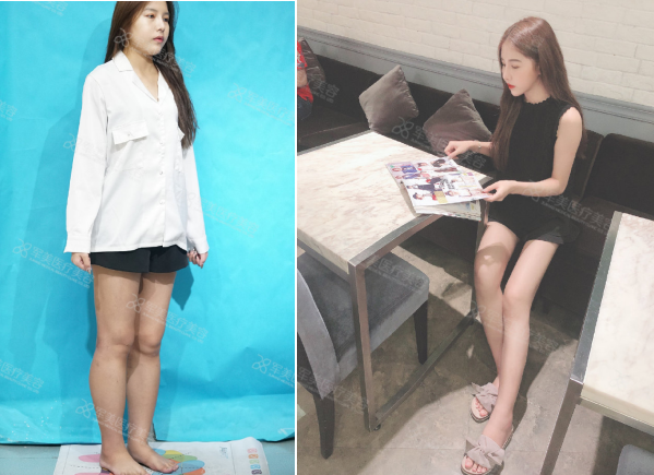 大腿|怎么样才能减肥，怎样有效减肥？