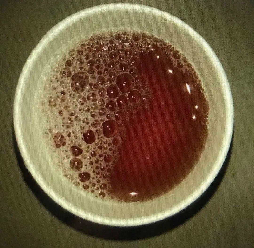 惊孩子的尿是彩色的这咋整