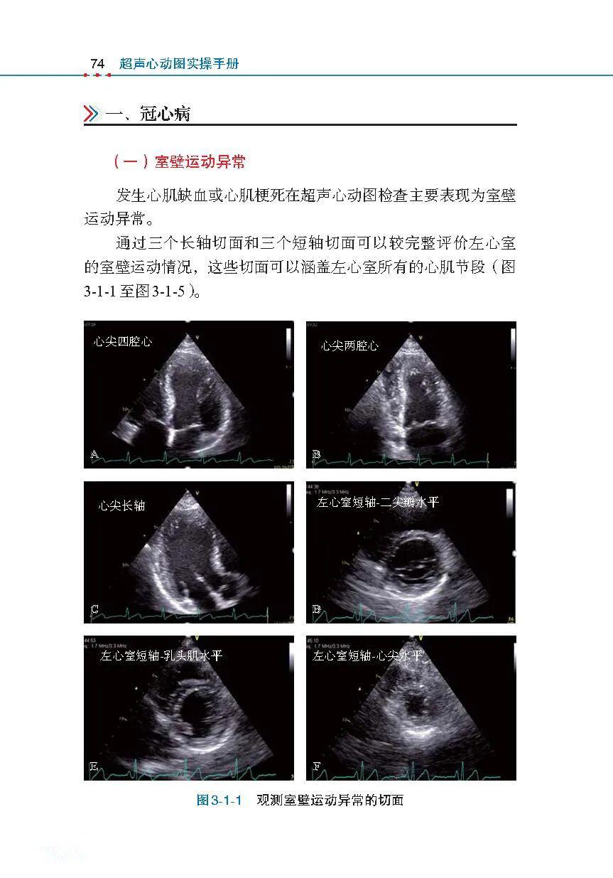 《超声心动图实操手册》:99个超声心动图影像视频,带你看图识病