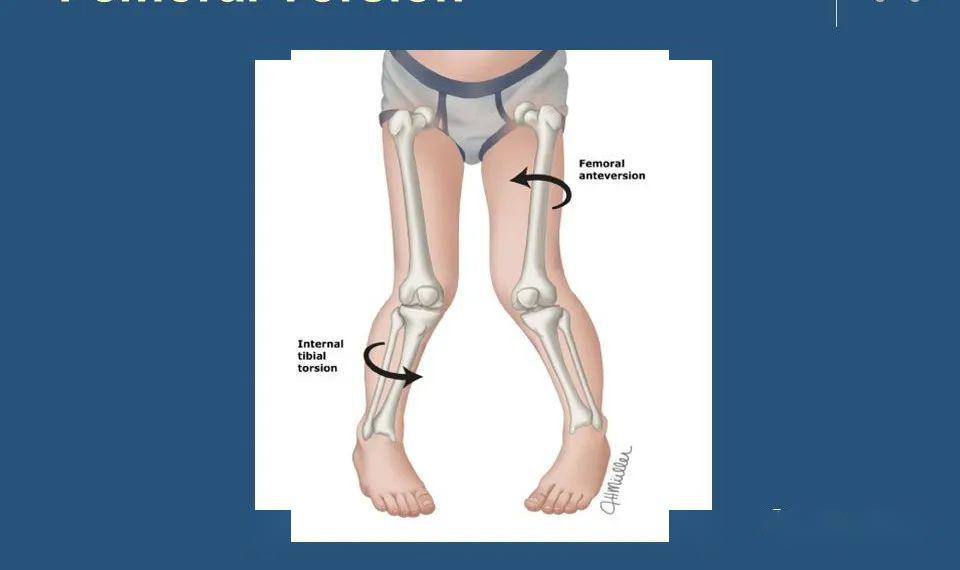 膝关节内外旋示意图图片