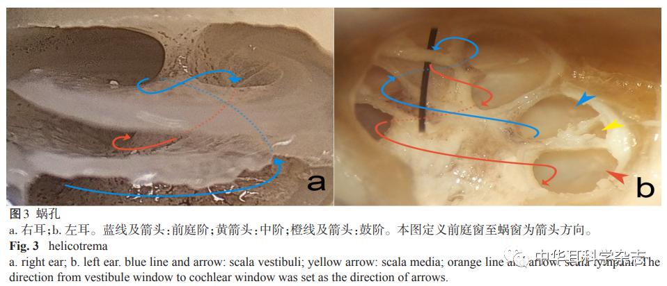 内耳及相关解剖结构的教学方法和经验