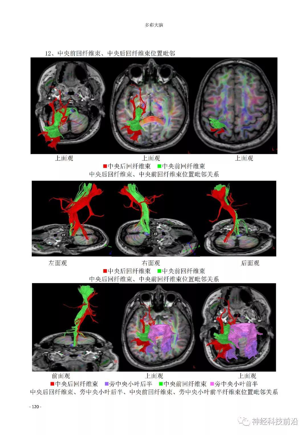 超精致12对颅神经dti纤维束成像