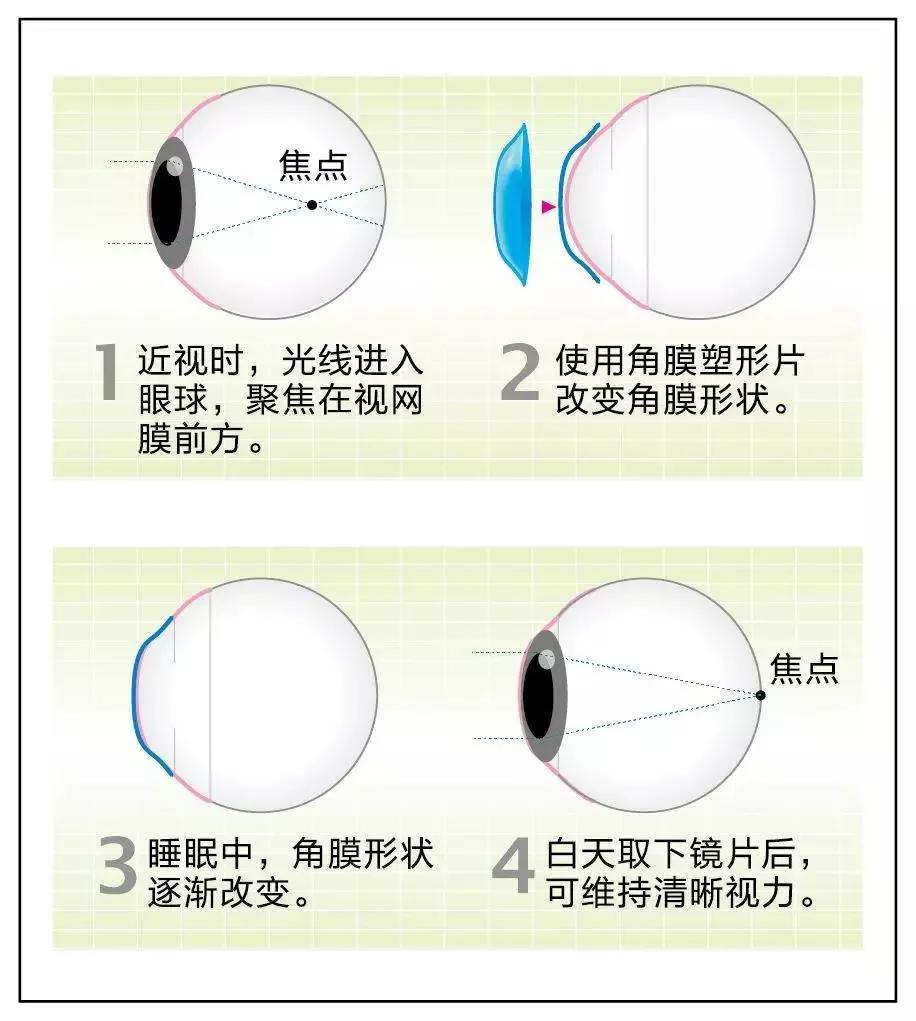 ok镜长什么样,效果好,小朋友(第17页)_大山谷图库