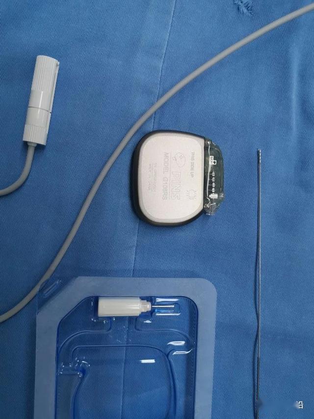 图9"品驰"可感知脑起搏器及3t兼容脑深部电极视频4 术后第一天,通过可