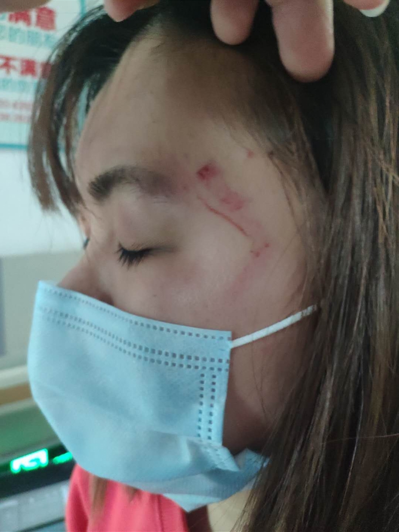 男子殴打两名广州护士被刑拘,伤者面部头皮损伤流血,仍在治疗