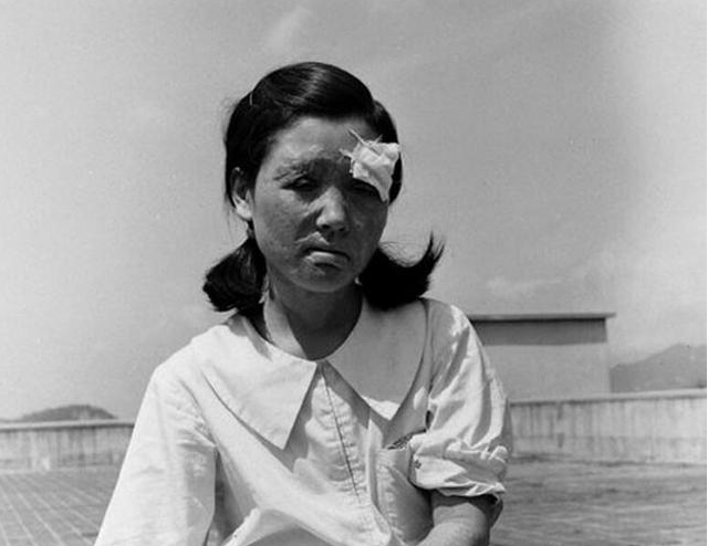 日本原子弹幸存者,痛苦一生,希望人类不要再制造"怪物"了!_爆炸