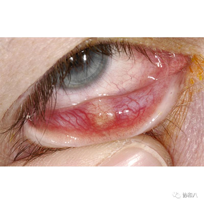 copd协和八每日一题