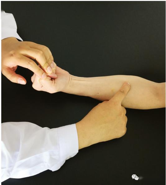 (2)桡侧腕屈肌(c6,c7,)是屈腕的2块主要肌肉之一,另个是由尺神经支配