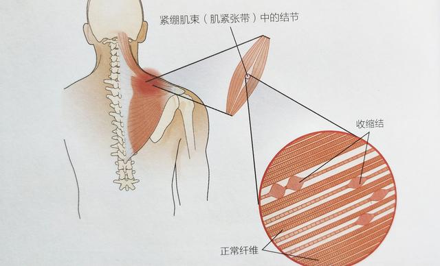 健身训练肩关节疼痛怎么办?3步循序渐进纠正训练,快速修复损伤