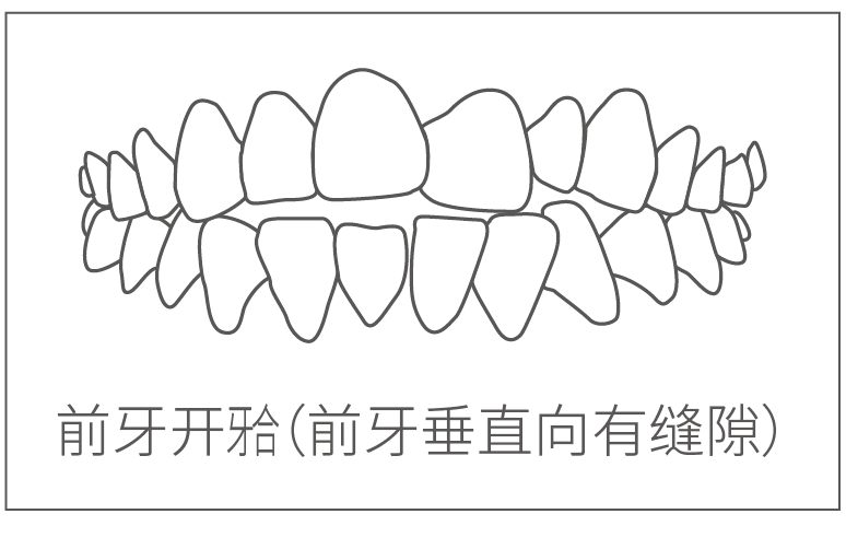 门齿臼齿,形状,位置_大山谷图库