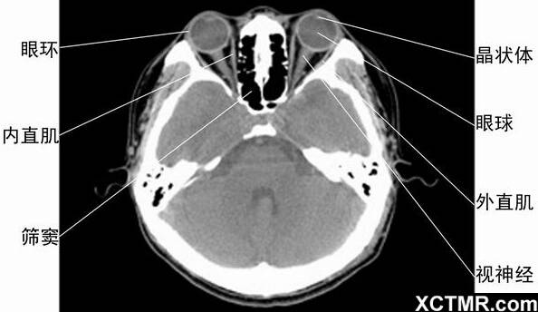 头颈五官ct断层解剖图
