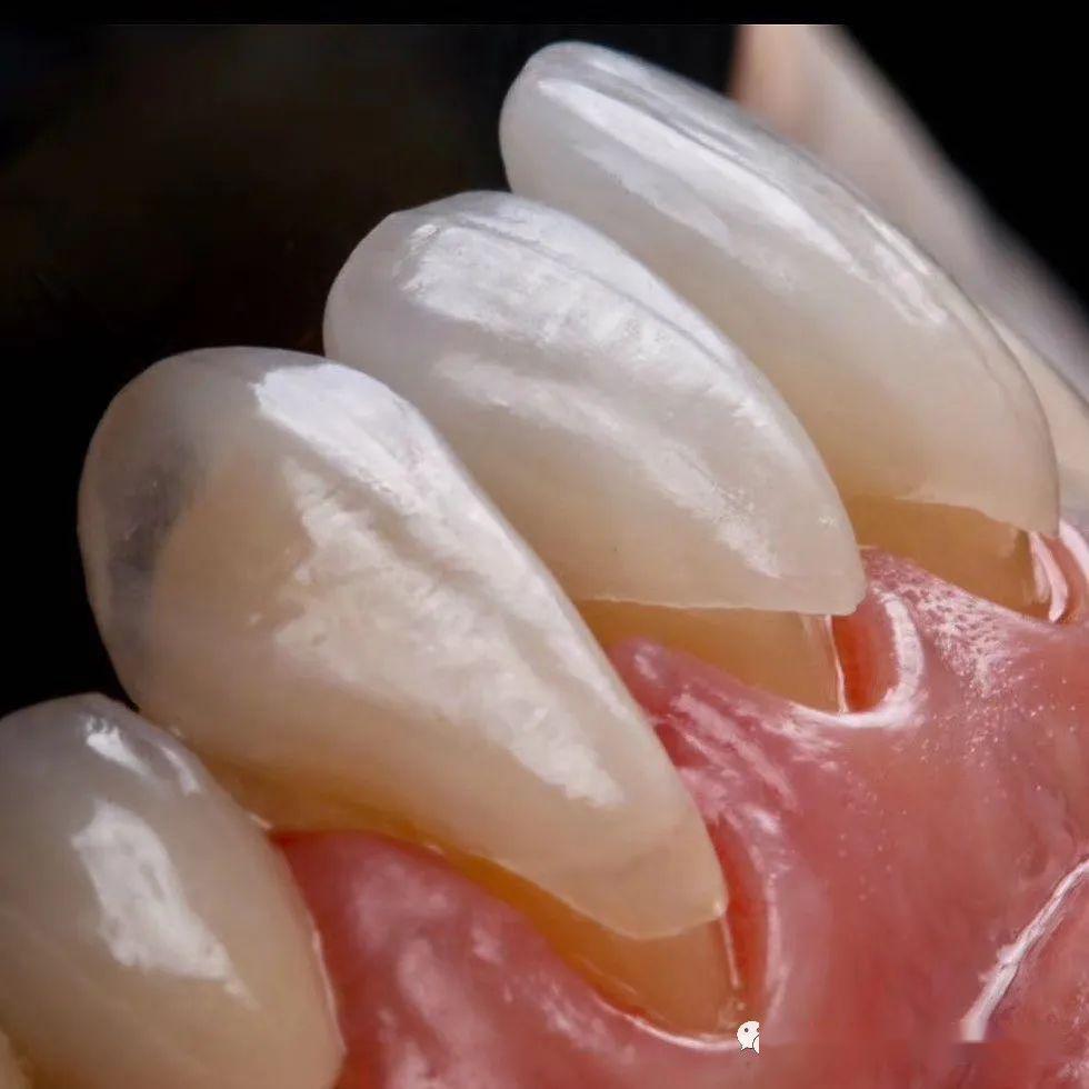 jalali等报道,将24颗人类下颌前磨牙随机分成两组:对照组预备肩台边缘