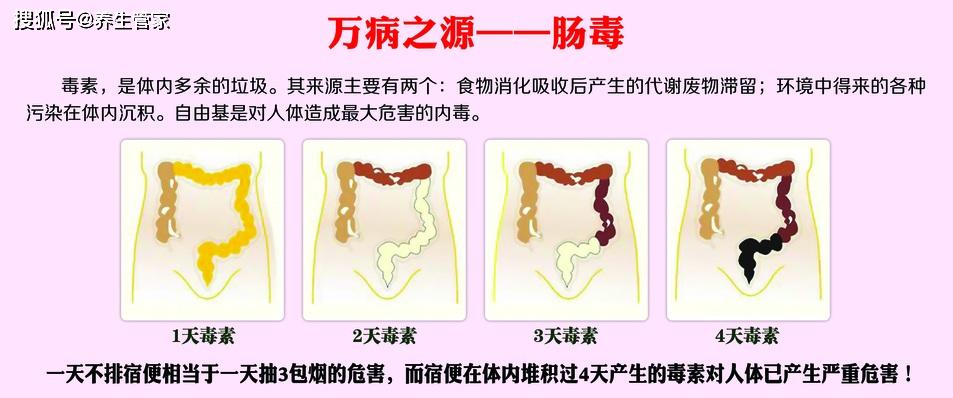 5釐米就有個褶皺,藏有宿便,每人身體裡有5—15斤宿便,便秘者可達15