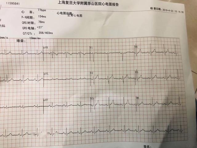 心电图正常心脏就没问题了吗