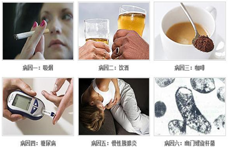 2020年肿瘤防治宣传周胰腺癌