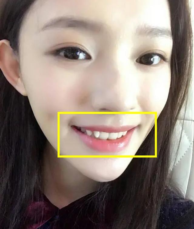 谁说整牙一定好看300万的牙真没用方法没对脸就是山路十八弯