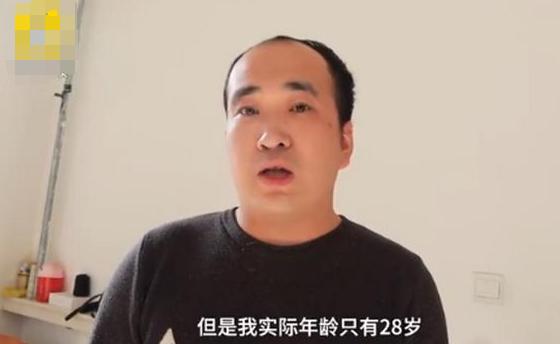 男朋友秃头了还能嫁吗?要是以后影响到孩子,那该怎么办?