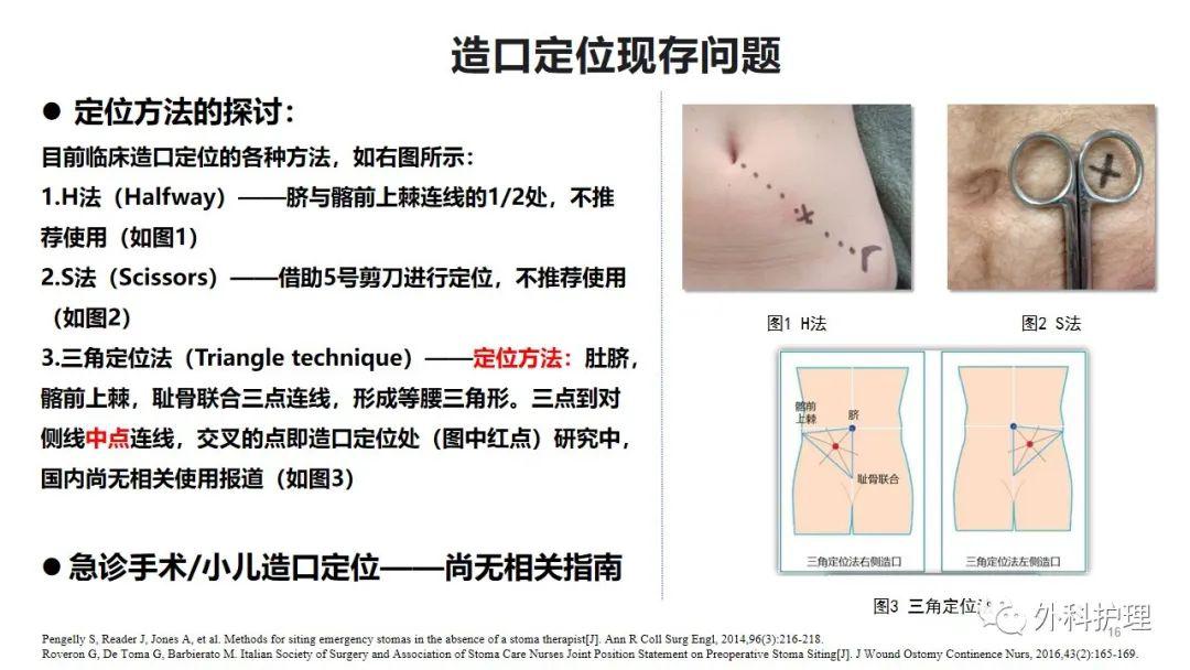 造口位置图片