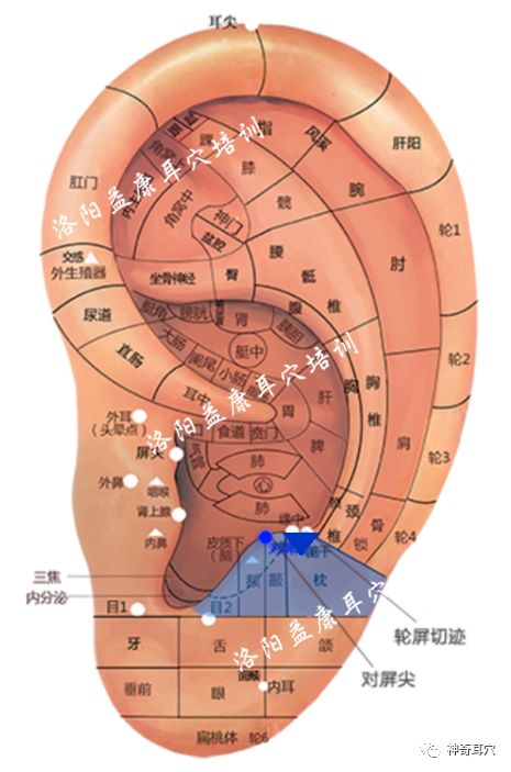 取穴:降压沟,降压点,肝穴,肾穴,心,肺,脾,交感