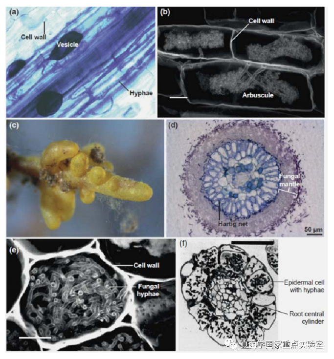 真菌王国科普系列之三小菌根的大作用