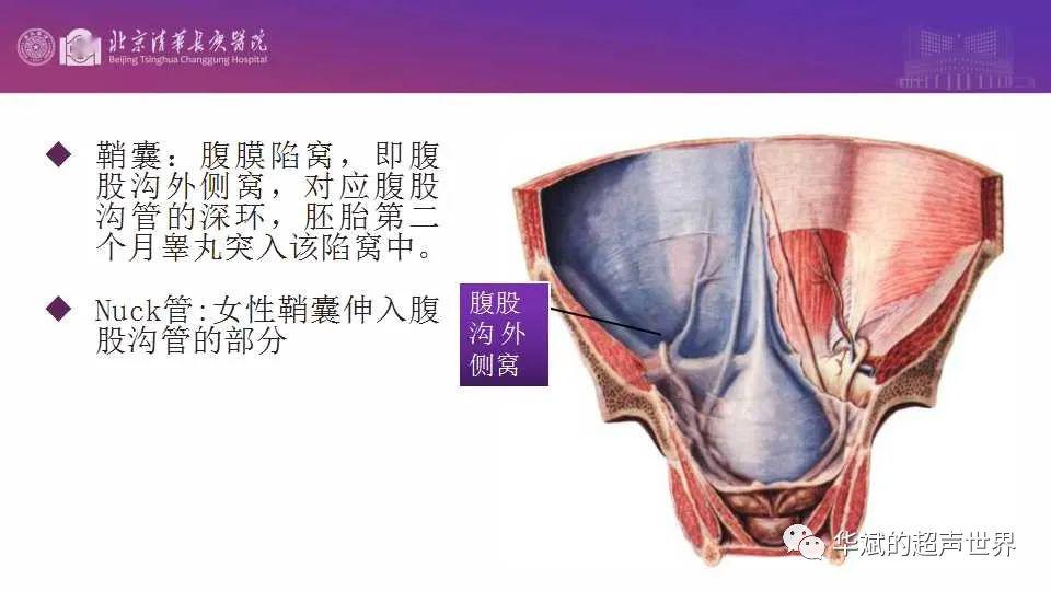 腹膜鞘状突位置图片图片