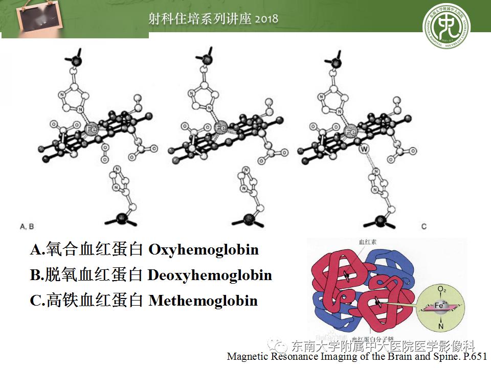 中大放射住培系列讲座脑内出血mr转归