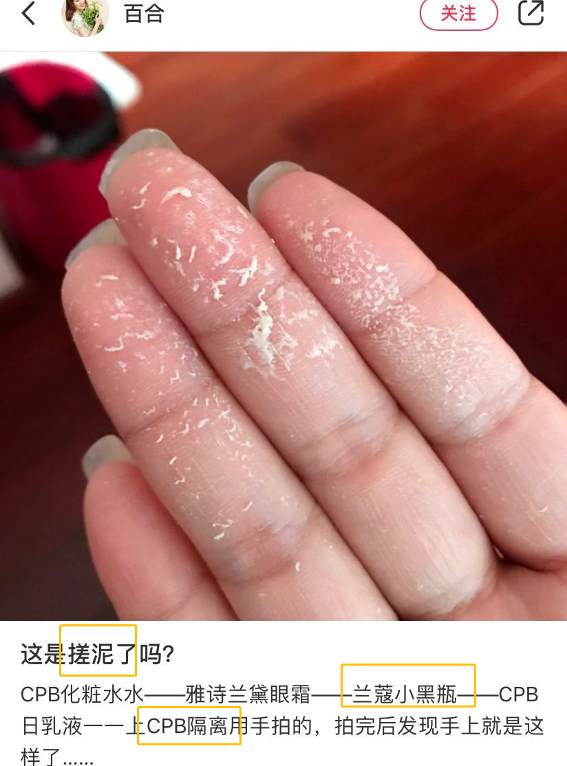 让你搓泥的死亡搭配:没想到小棕瓶也中招了!