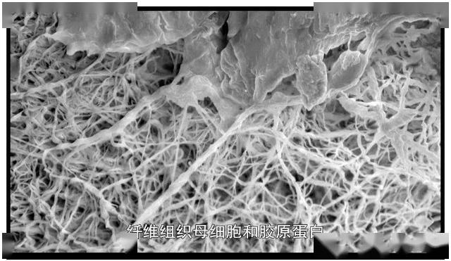 这个网状结构需要依靠纤维组织母细胞将胶原蛋白联系在一起