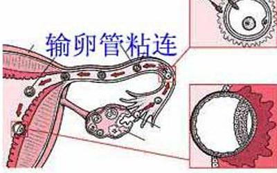 女生身体里的这把小伞千万别生病!_输卵管