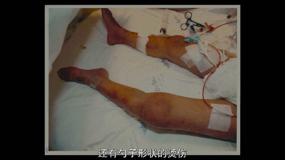 令人窒息的94分虐童案气到浑身发抖