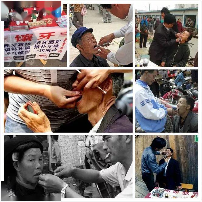茂名人警惕街头这些江湖牙医真是害人害己曝光他们